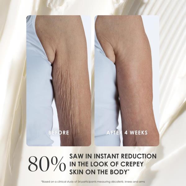BODY FIRM Crepe Erase Advanced Body Repair Treatment, Anti-Aging Skin Care Moisturizer for Body and Neck, Firming Cream to Support Wrinkle, Promotes Natural Elastin & Collagen Production, 10 oz